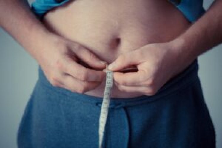 Treat obesity as chronic disease, not lack of will — paper