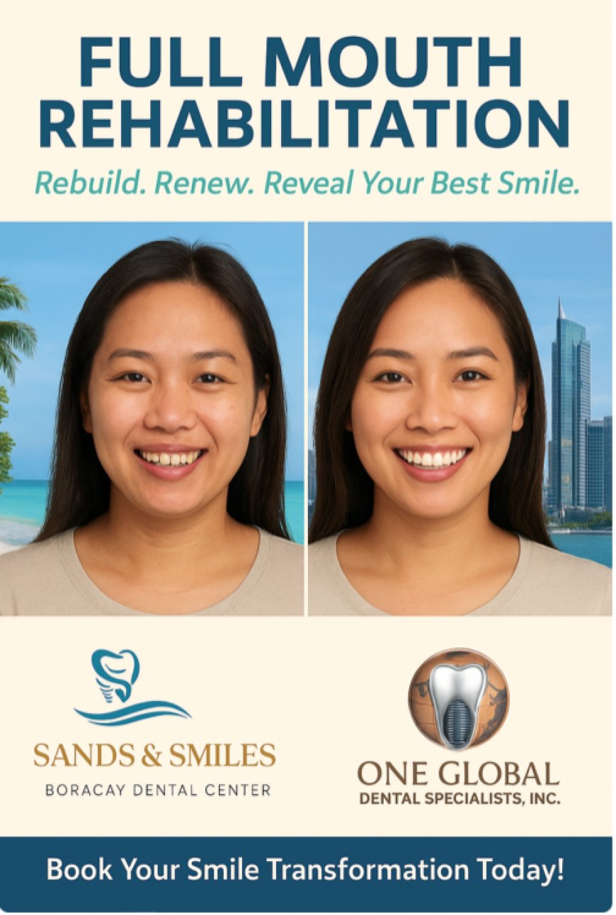 Smile Reborn: Full Mouth Rehabilitation and Makeover in Boracay and BGC